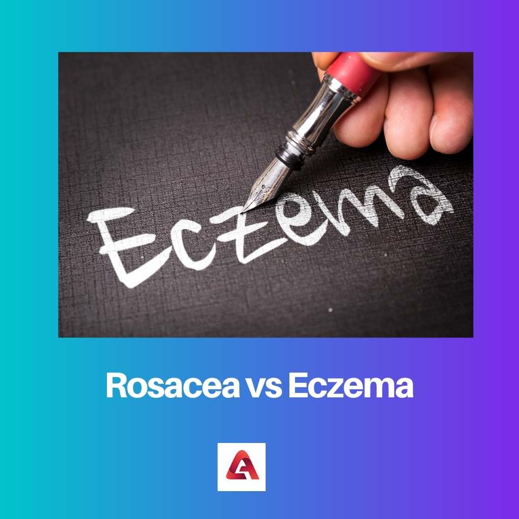 Rosacea versus eczeem