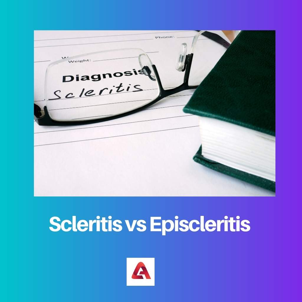 Sclerite vs Episclerite