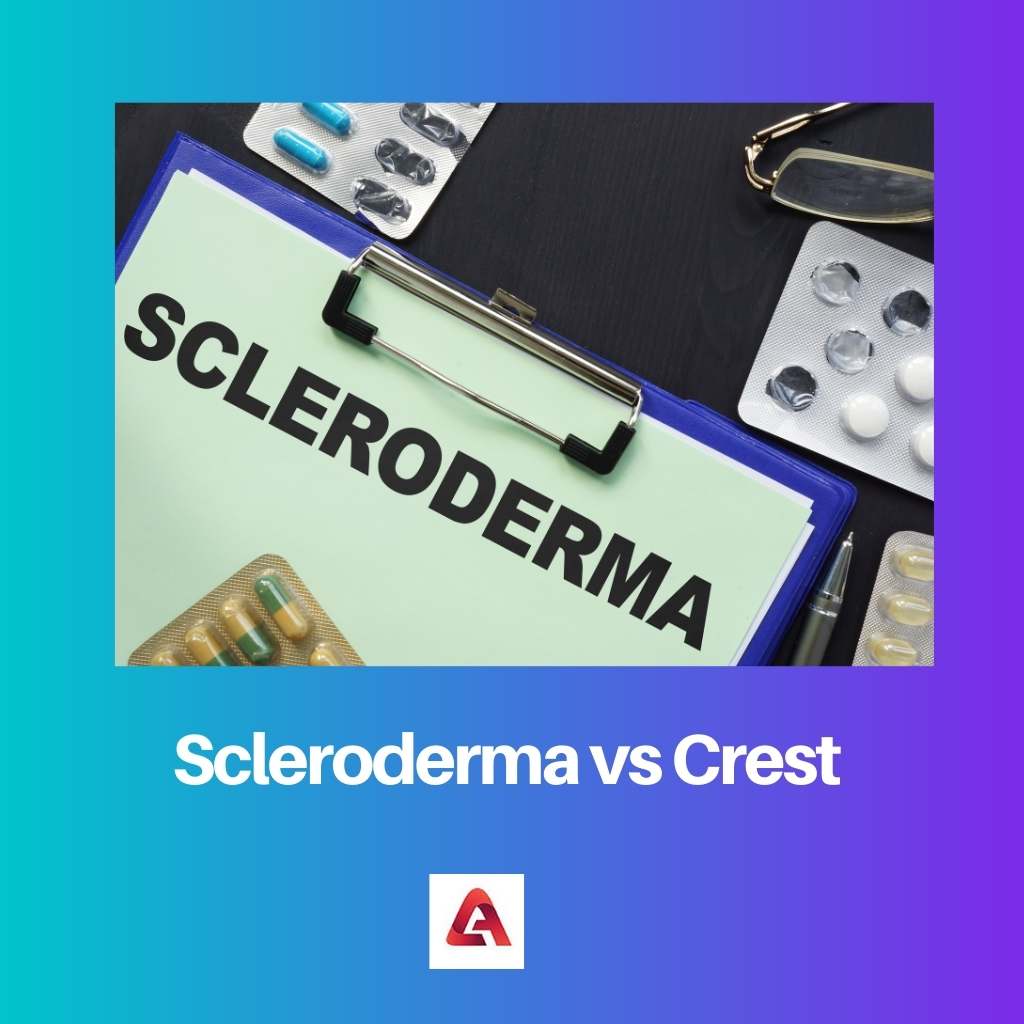 Scleroderma vs Crest