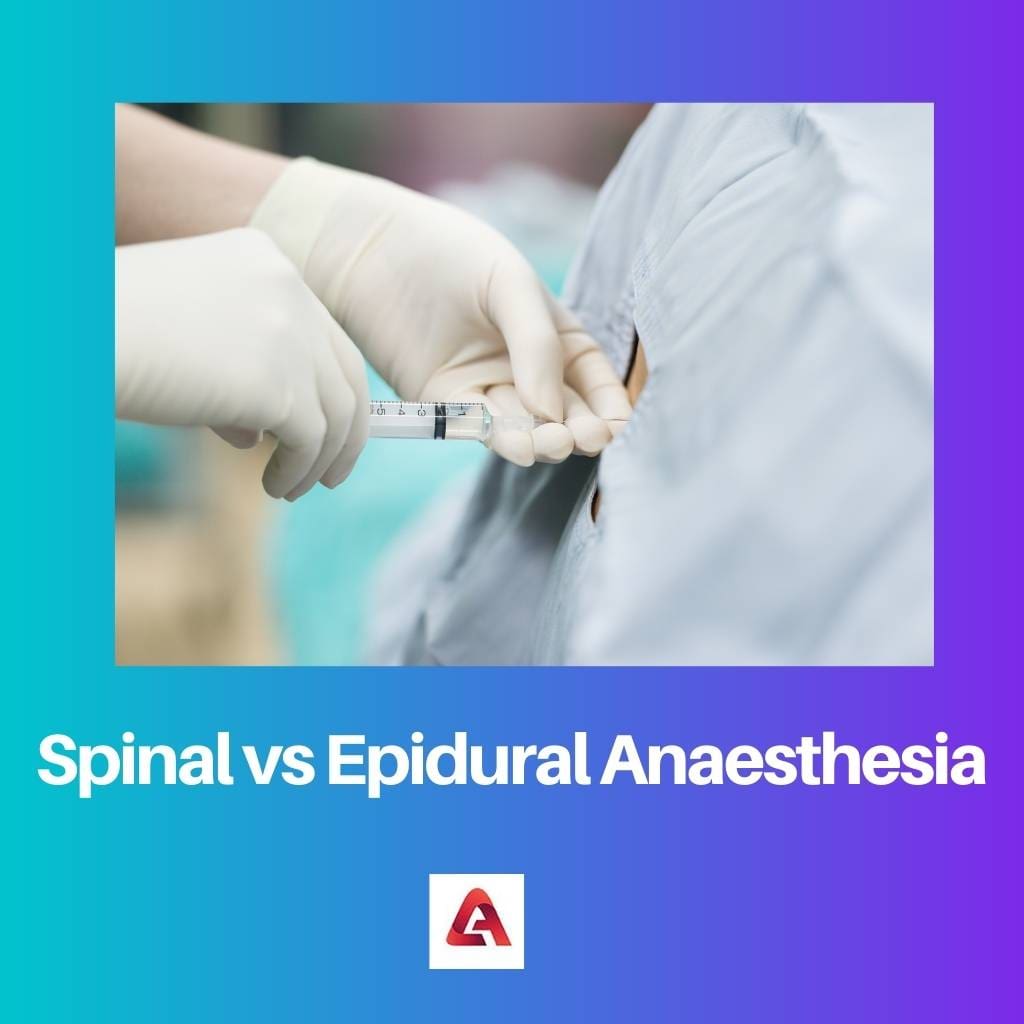 Anestesia espinal vs epidural