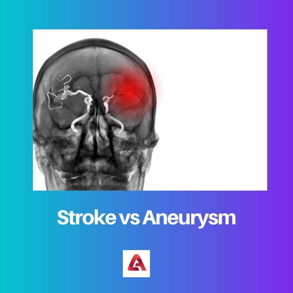 Beroerte versus aneurysma