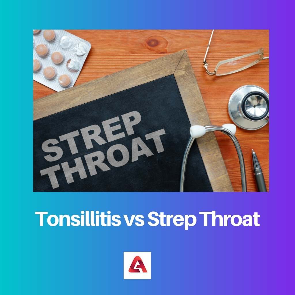 Tonsillitis vs Strep Throat
