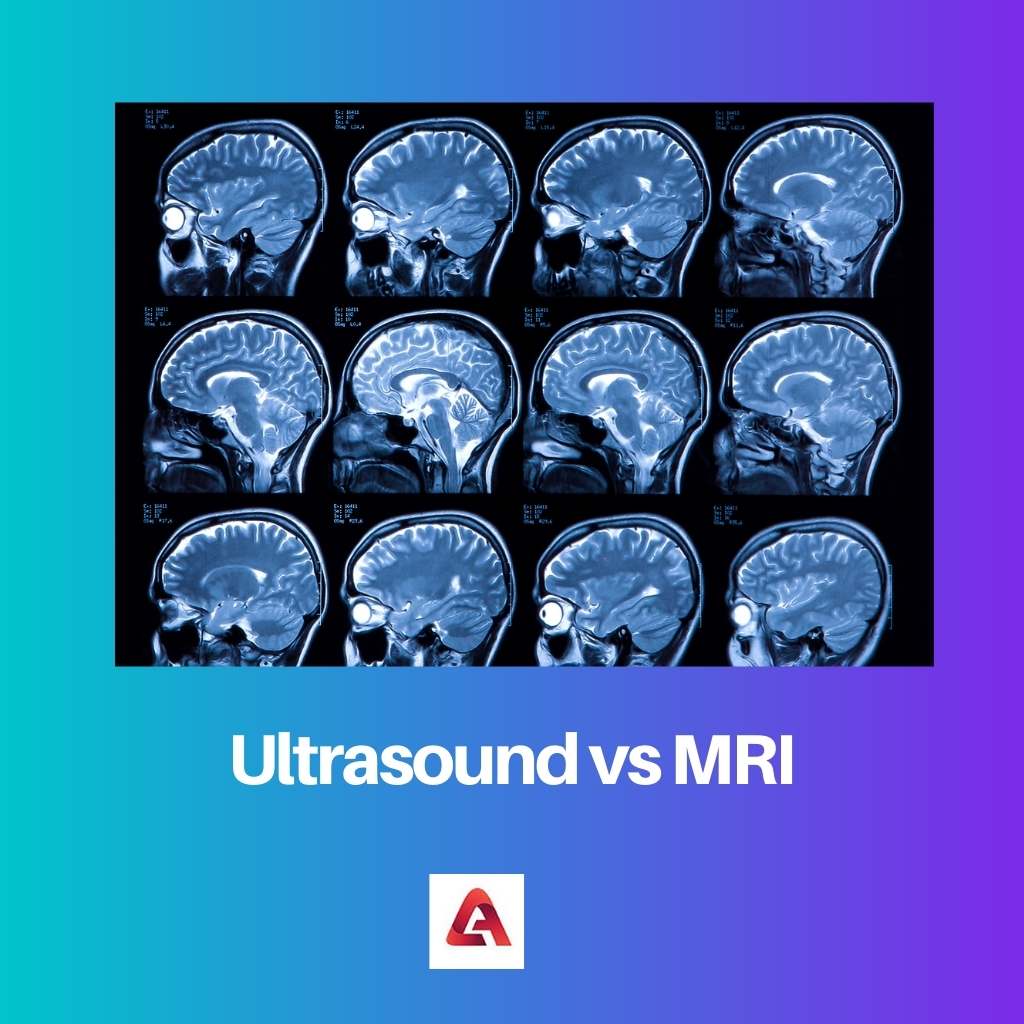 Echografie versus MRI