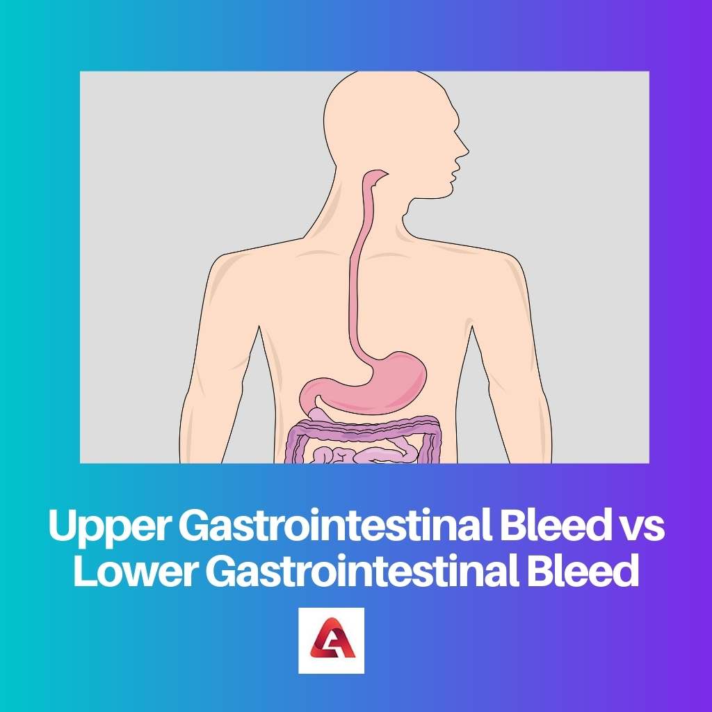 Obere gastrointestinale Blutung vs. untere gastrointestinale Blutung