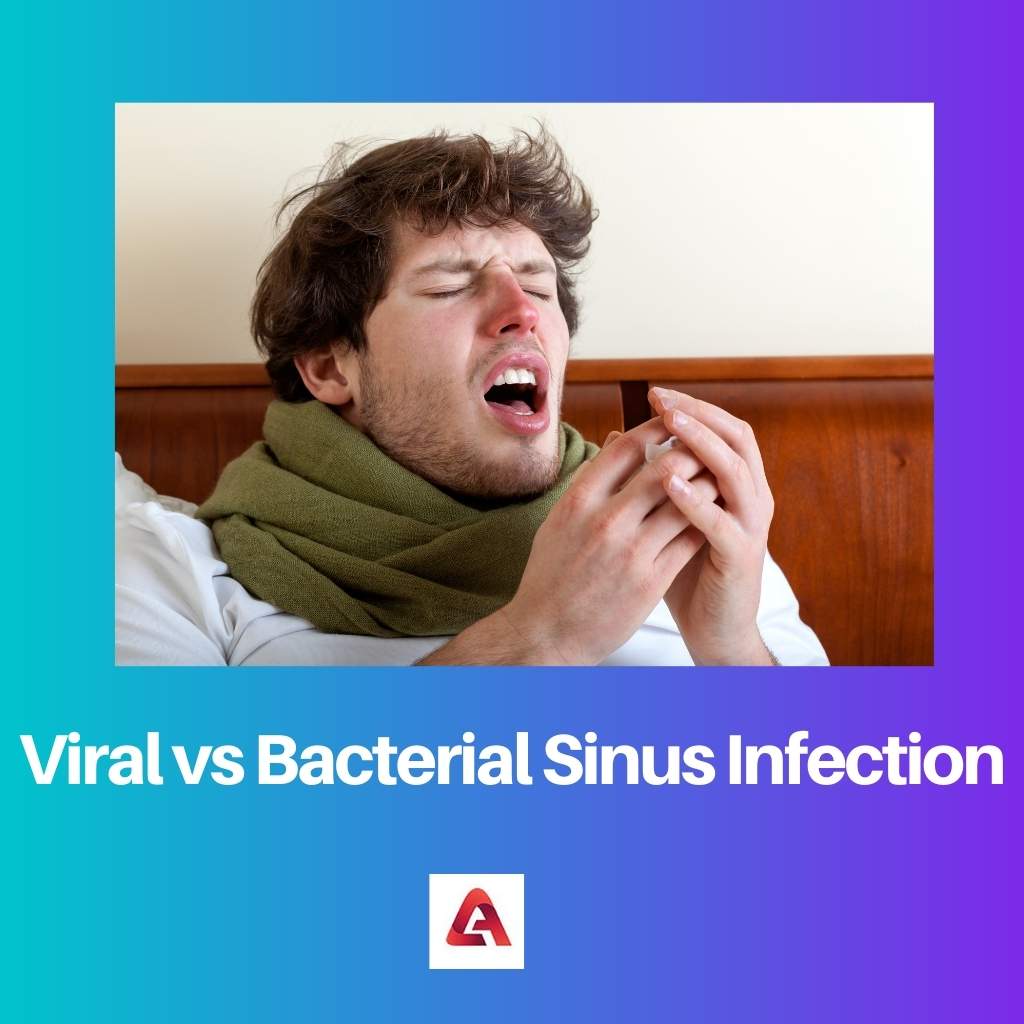 Viral vs Bacterial Sinus Infection