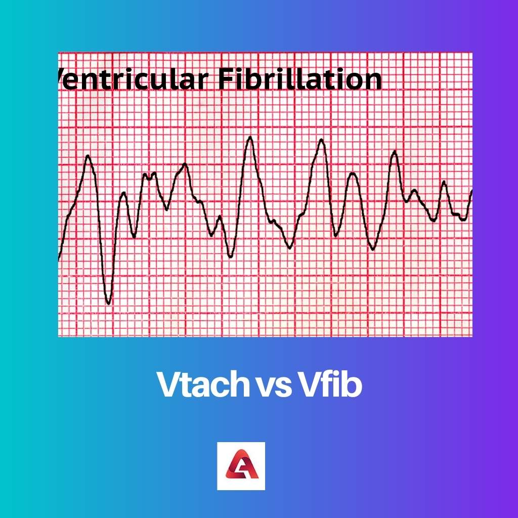 Vtach versus Vfib