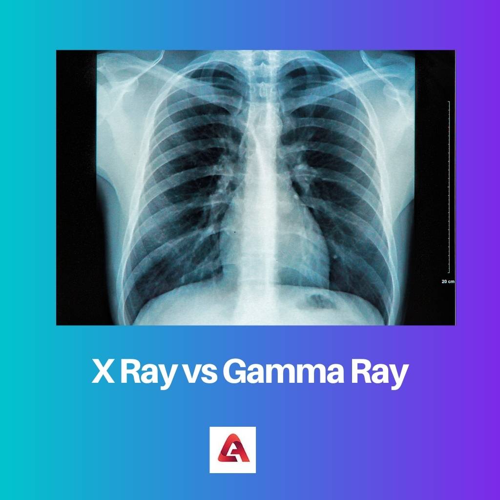 Röntgenstrahlen gegen Gammastrahlen