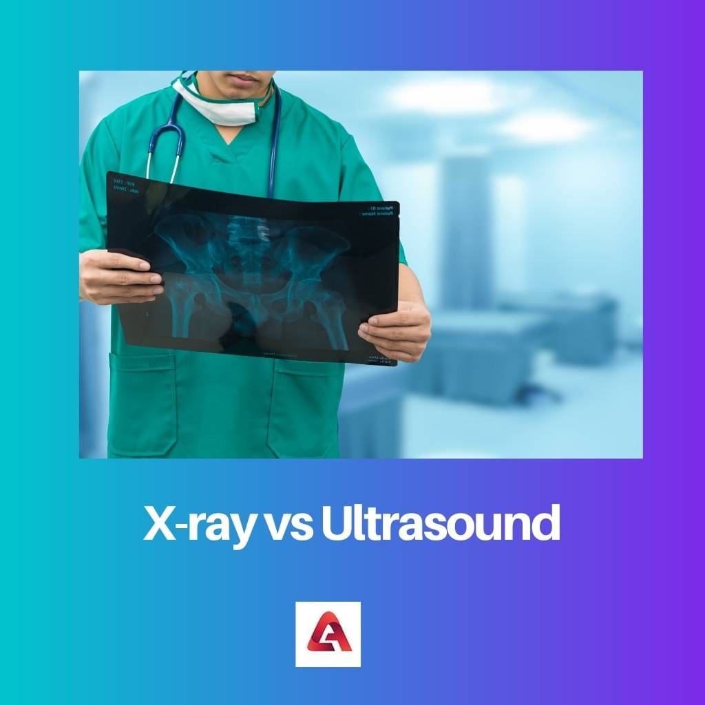 X-ray vs ultrazvuk