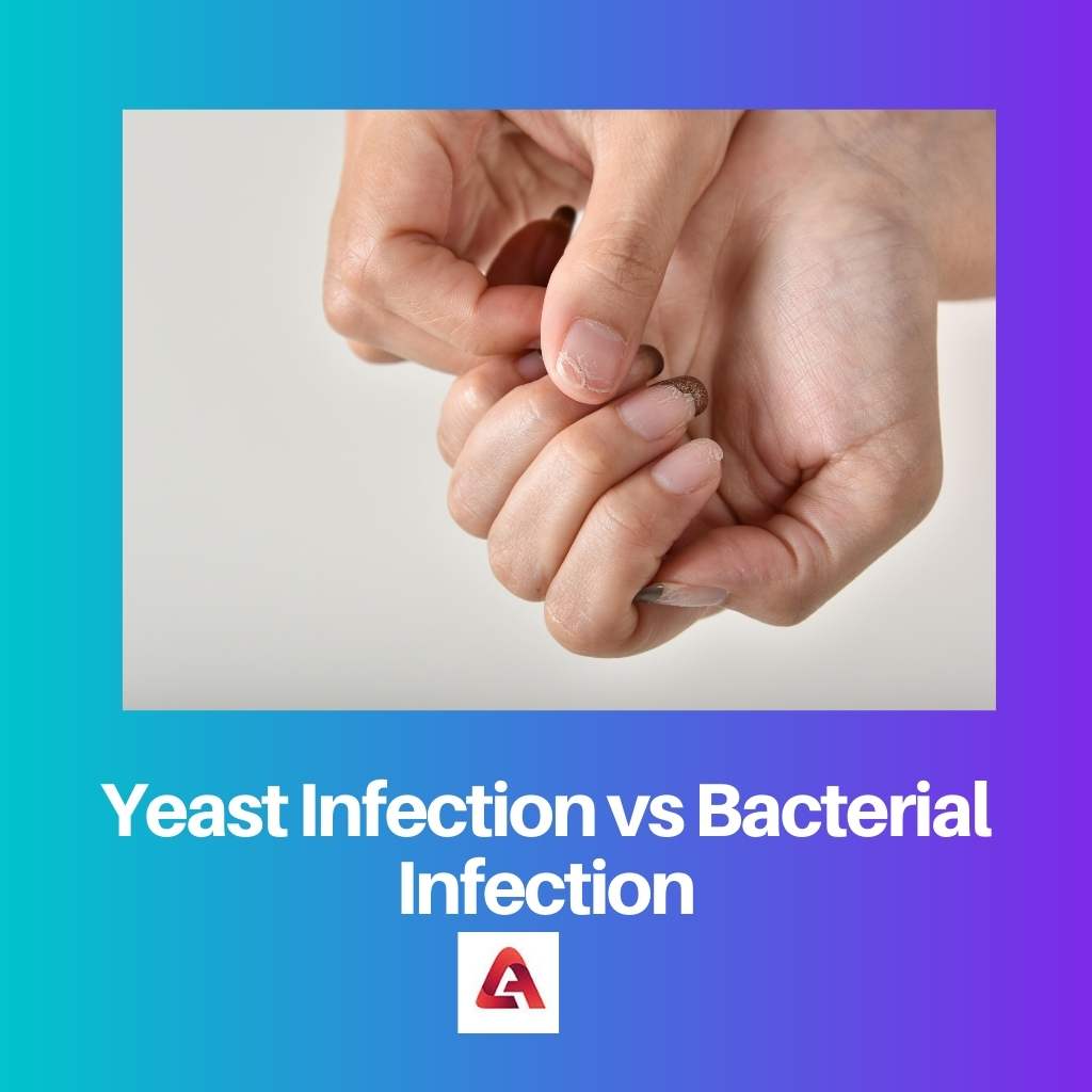 Yeast Infection vs Bacterial Infection