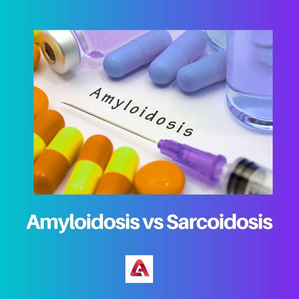 Amylose vs Sarcoïdose