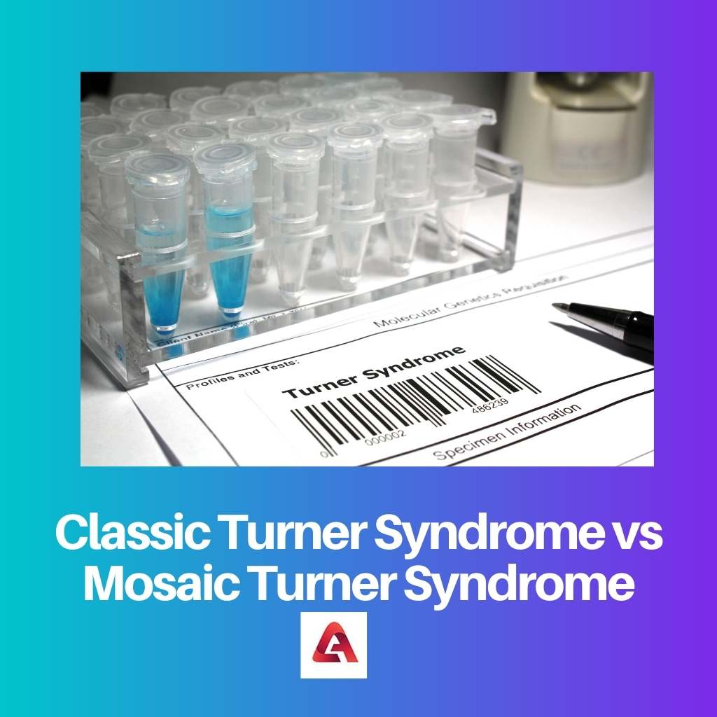 Síndrome de Turner Clássica x Síndrome de Turner em Mosaico