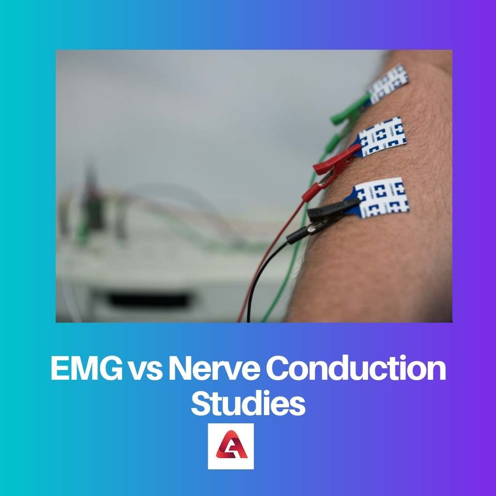 Λάβετε vs EMG vs Μελέτες αγωγιμότητας νεύρων