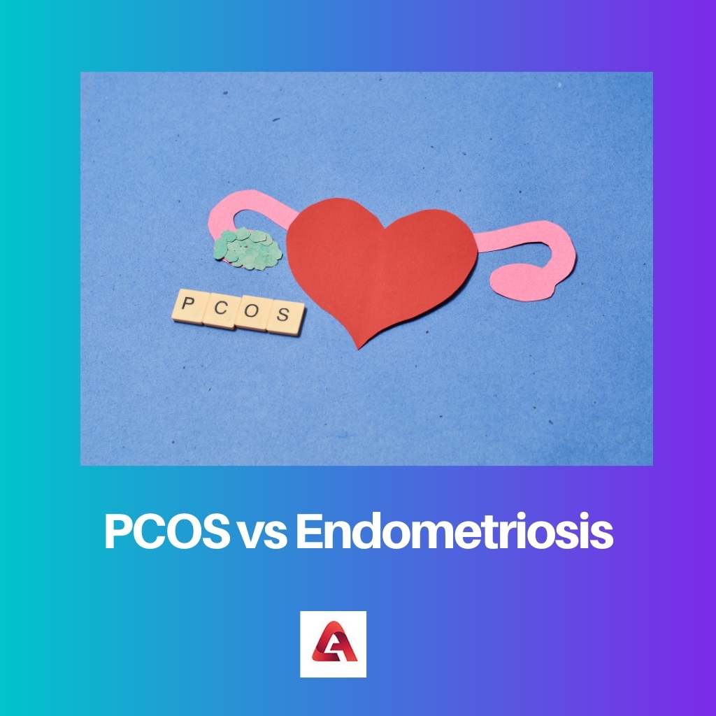 PCOS vs 子宮内膜症