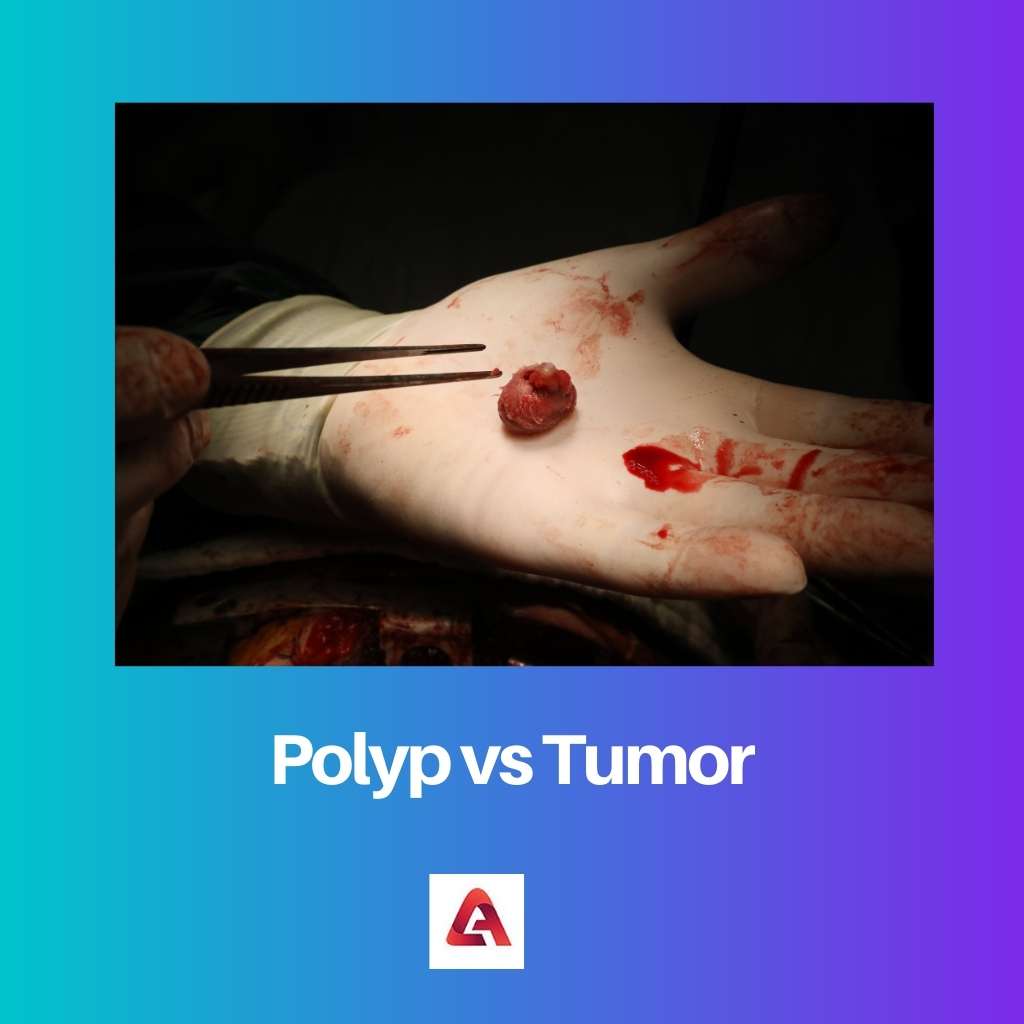 ポリープ vs 腫瘍