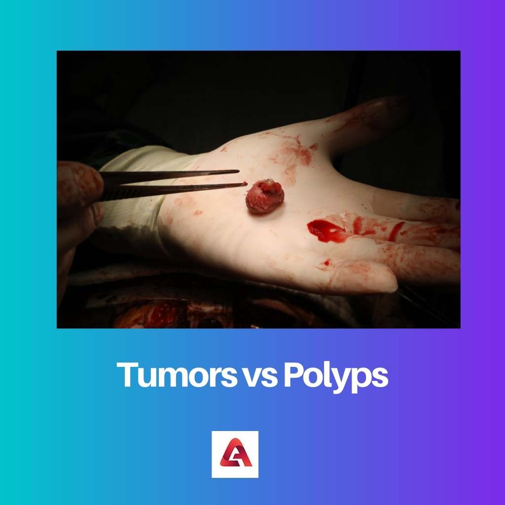 Tumores vs Pólipos
