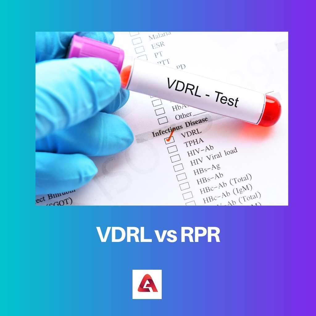 VDRL vs RPR