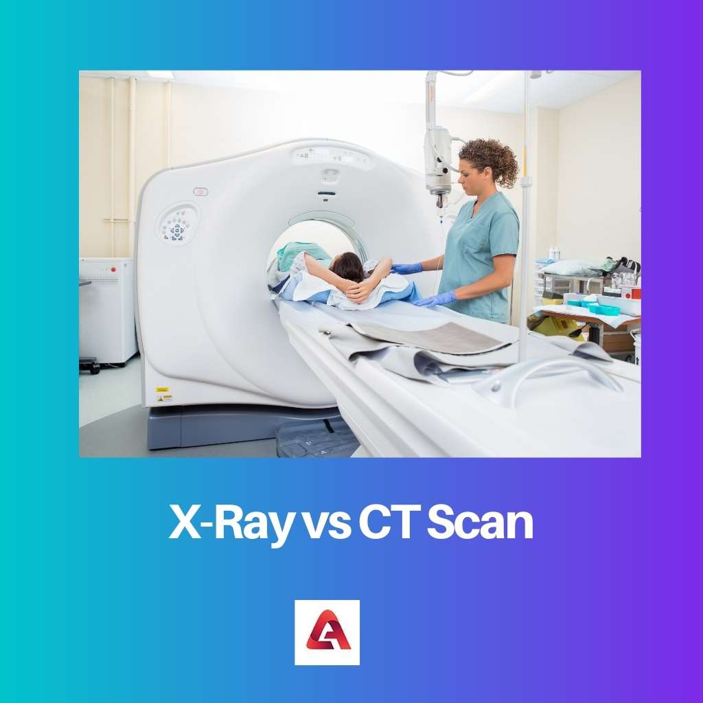 X Ray vs CT Scan