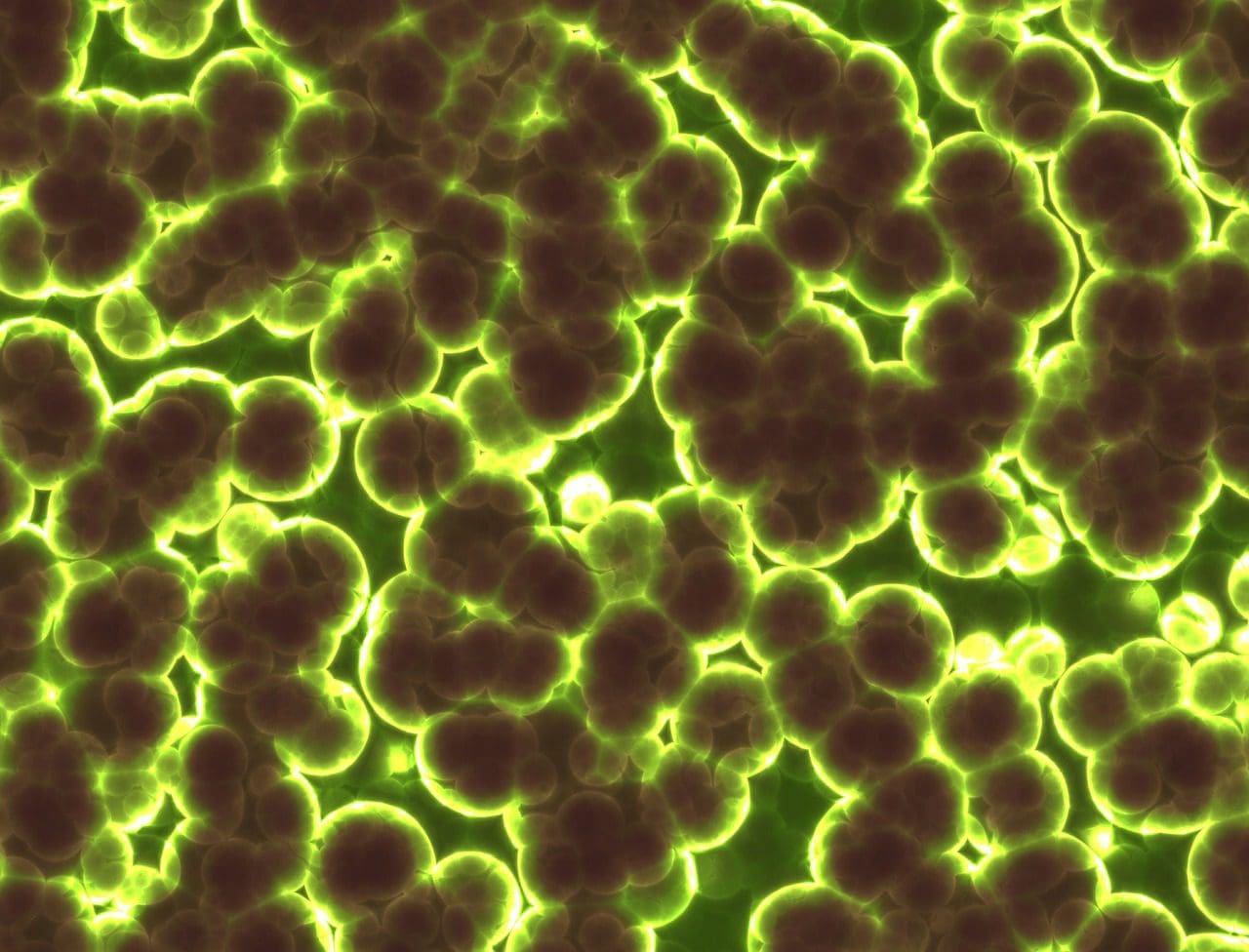 cyanobacteriën