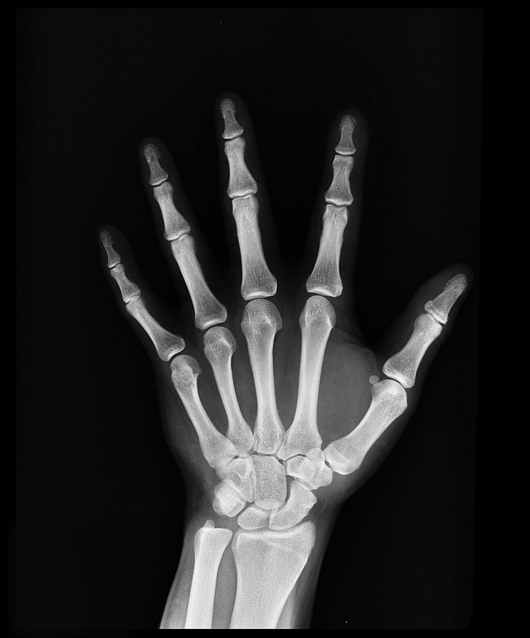 x ray