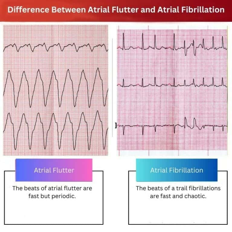 Atrial Flutter vs Atrial Fibrillation: Difference and Comparison