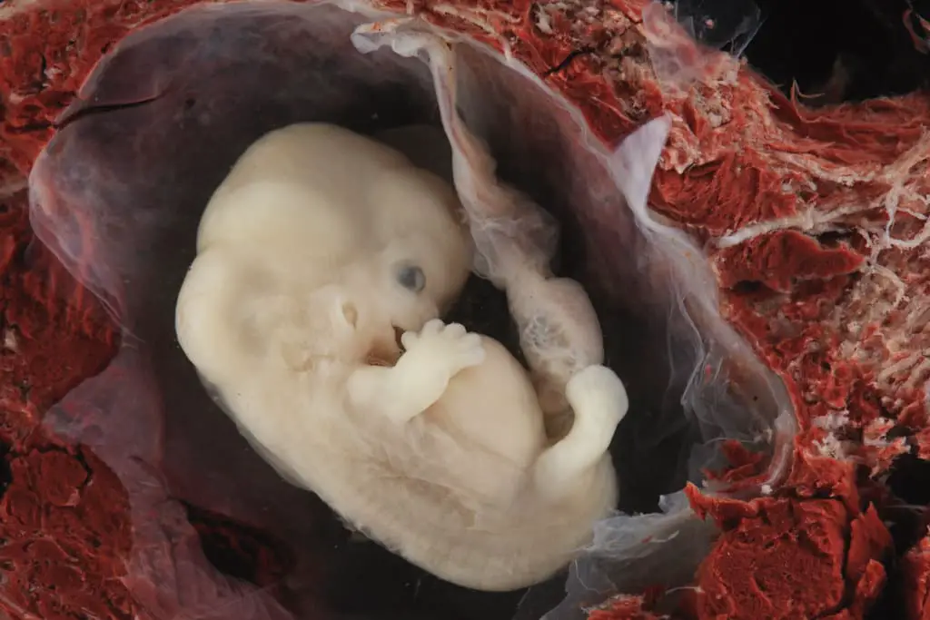 embrião