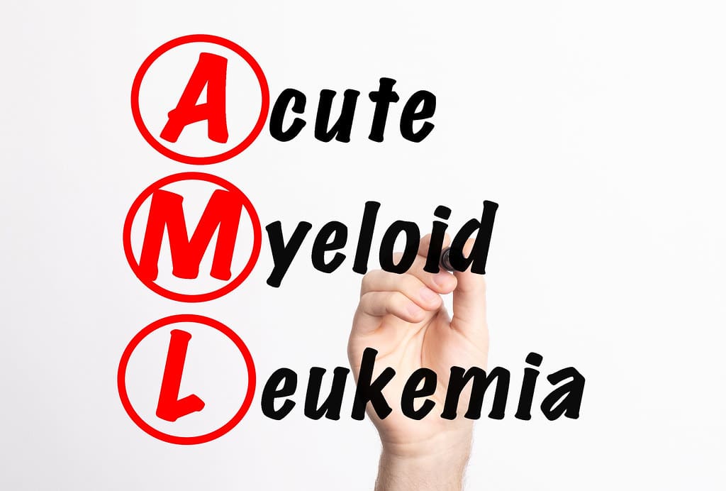 leukemia myeloid akut