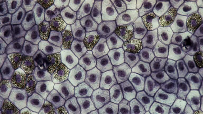 Epithelial Vs Connective Tissue Difference And Comparison