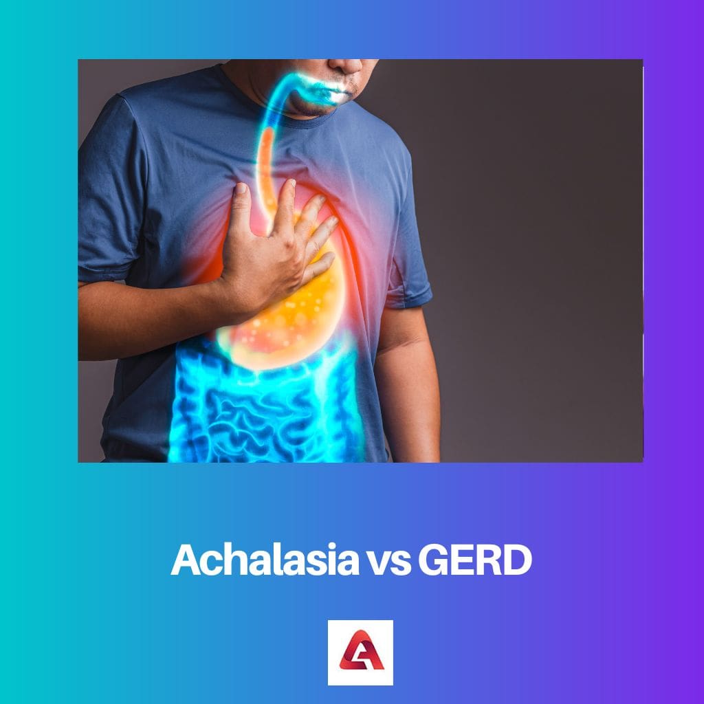 Achalasia vs GERD