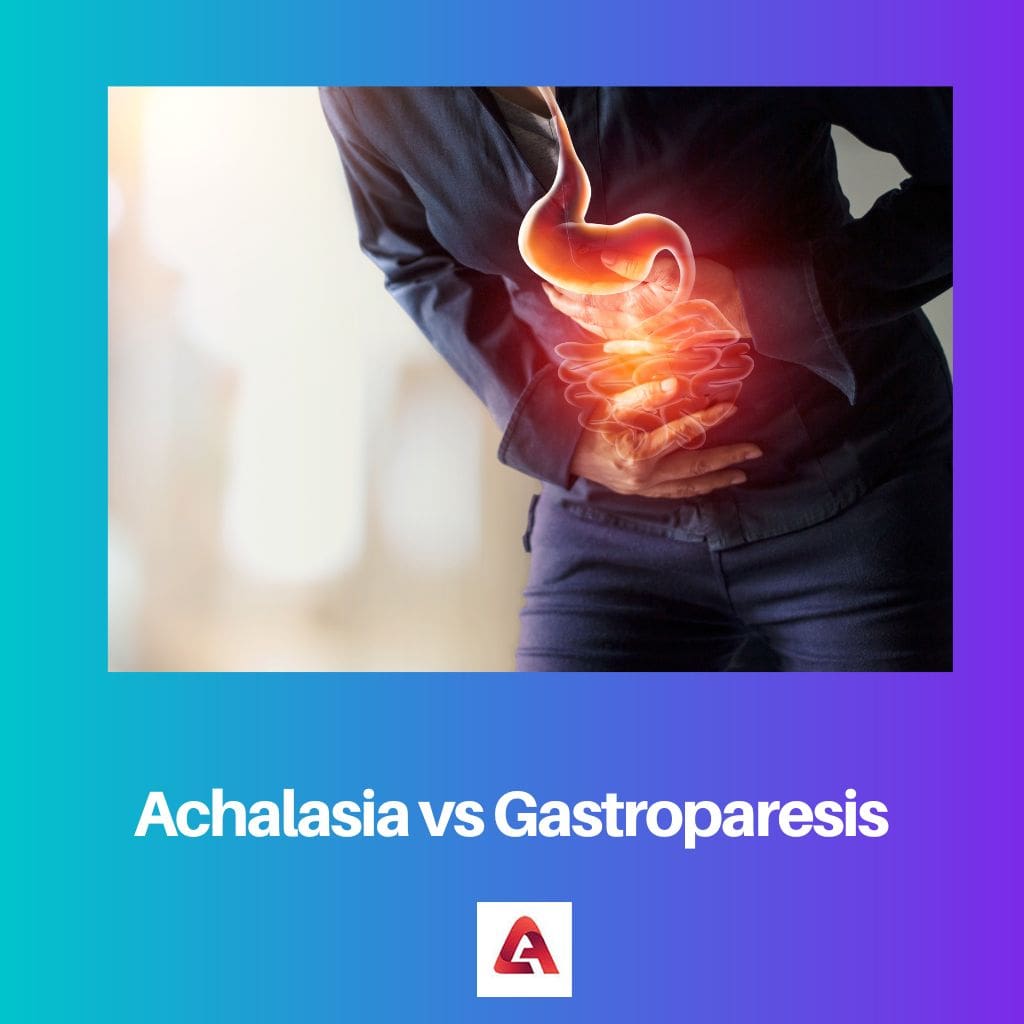 Achalasia vs Gastroparesis