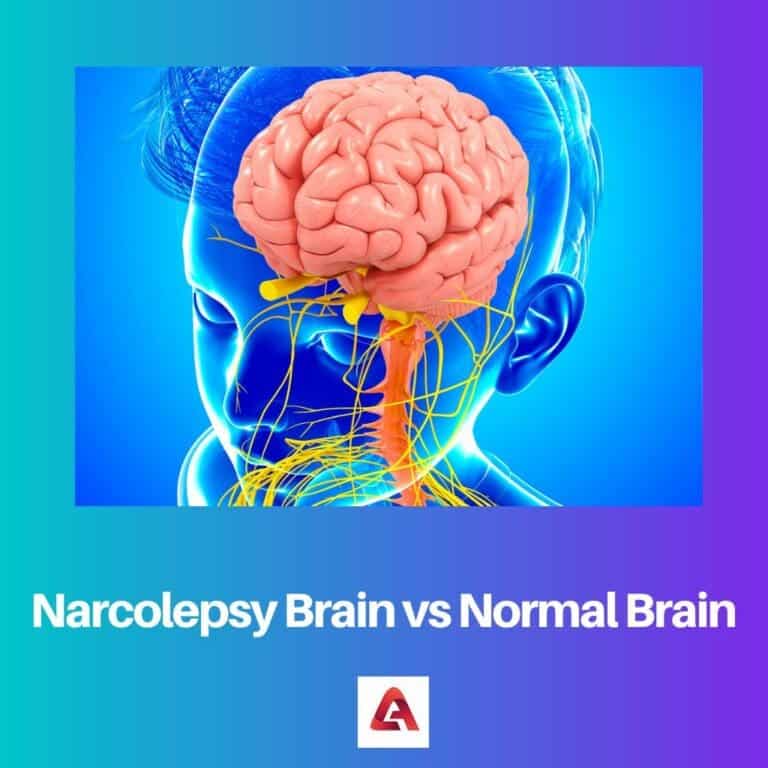 Narcolepsy Brain vs Normal Brain: Difference and Comparison