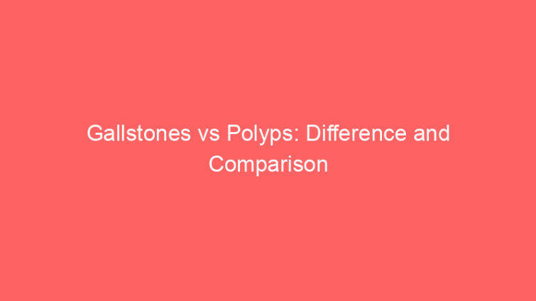 gallstones vs polyps difference and comparison 658554