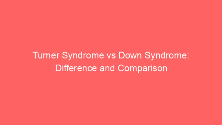 turner syndrome vs down syndrome difference and comparison 652554